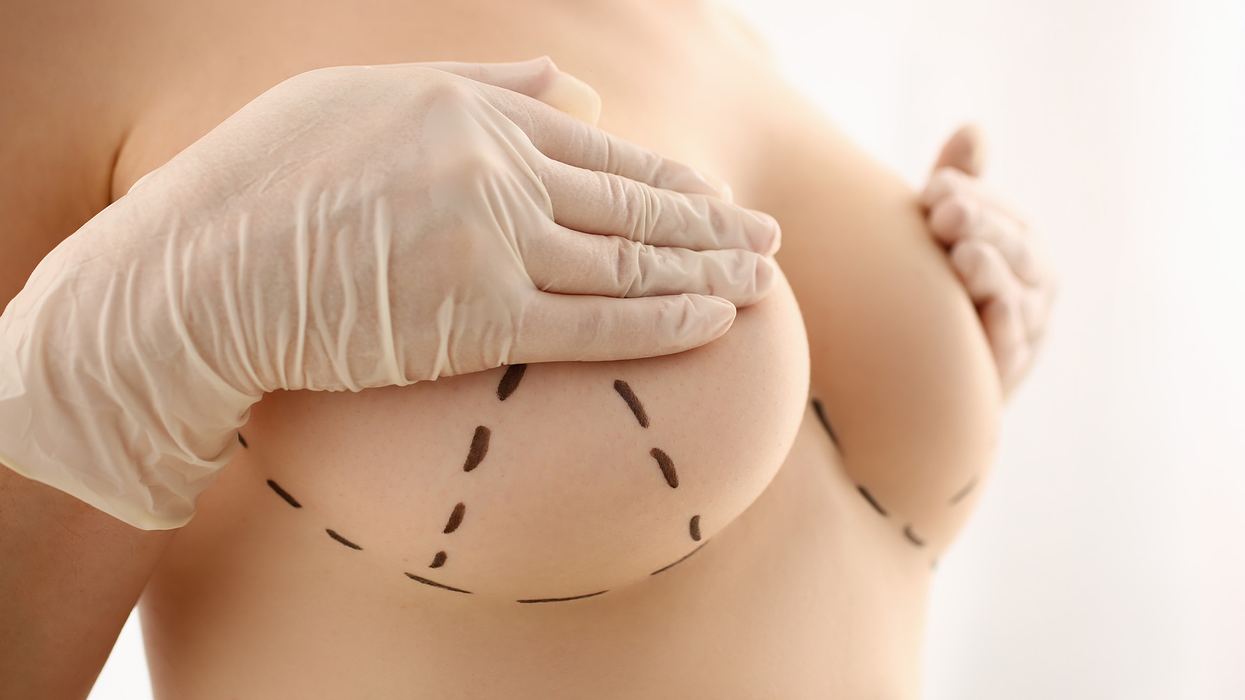 Meme Küçültme Ameliyatı